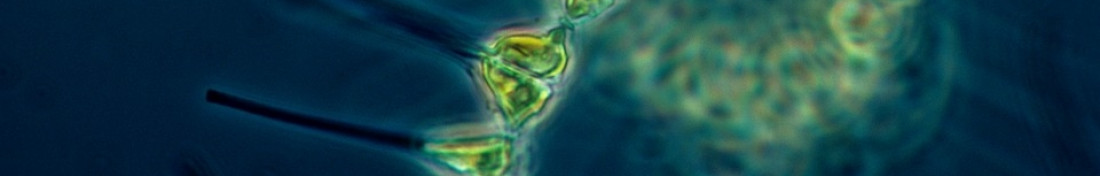 phytoplankton-1348508_960_720